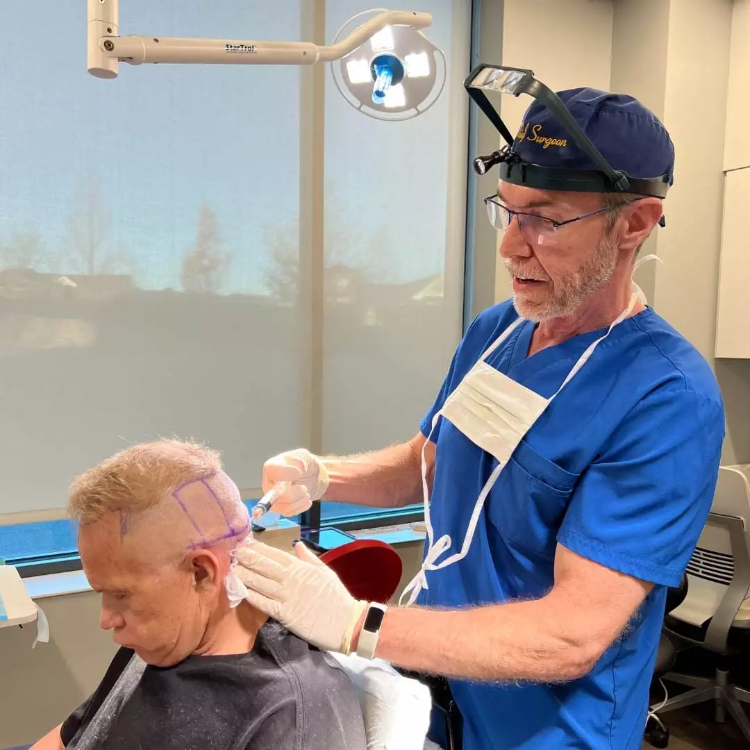 Russ Youngblood's hair restoration journey with Dr. Ken Anderson at Anderson Center for Hair in Atlanta