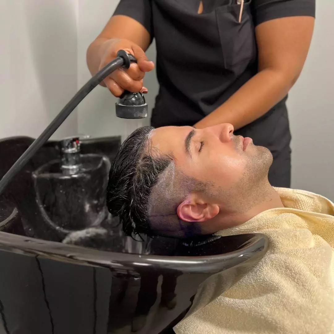 Dr. Neel Malhotra's hair restoration journey at Anderson Center for Hair in Atlanta