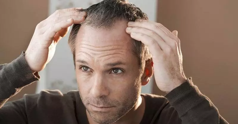 The Emotional Journey of Hair Loss: Nurturing Your Self-Esteem